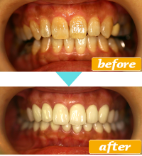 AKIデンタルクリニックのホームページにお越しいただきまして有難う御座います。